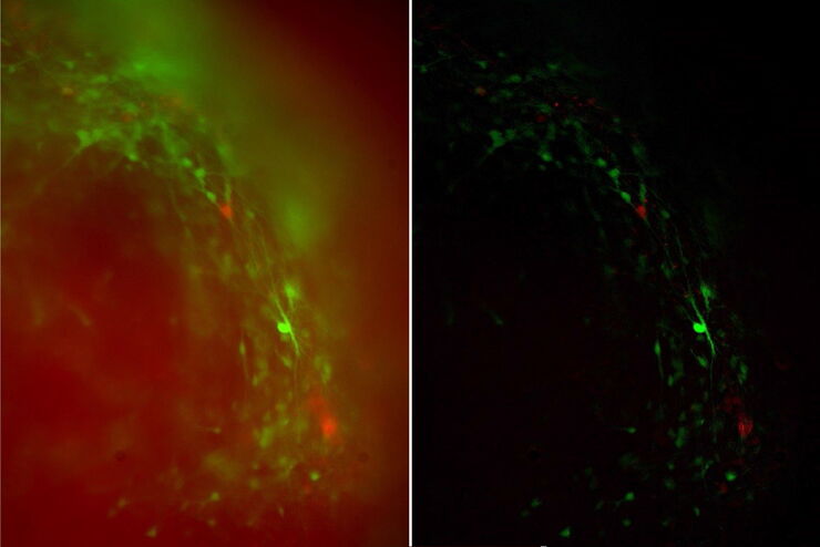 Images of a brain organoid derived from iPSCs acquired with a THUNDER Imager 3D Cell Culture. The cells were infected with the pAAV-hSyn-EGFP and pLX-hGFAP-mCherry virus. The image is the 36th plane cropped out of a 53 plane Z-stack volume. Shown are both the A) raw widefield image and B) the same image after Large Volume Computation Clearing (LVCC). Neurons are labeled in green and astrocytes in red.