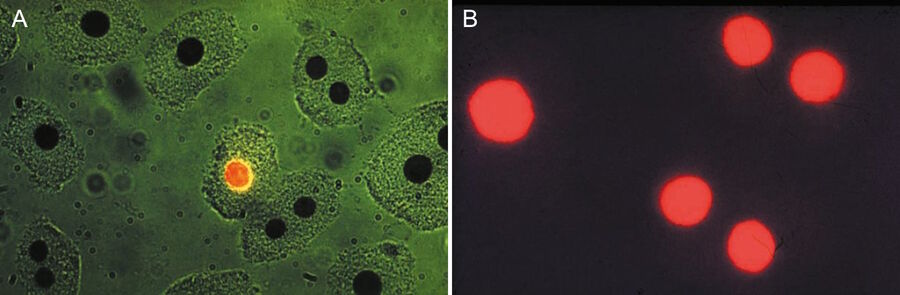 Liver tissue. Nuclei stained with Feulgen-pararosanilin for DNA and visualized with transmitted green light (A) and epi-illumination with narrow-band green light (B). 