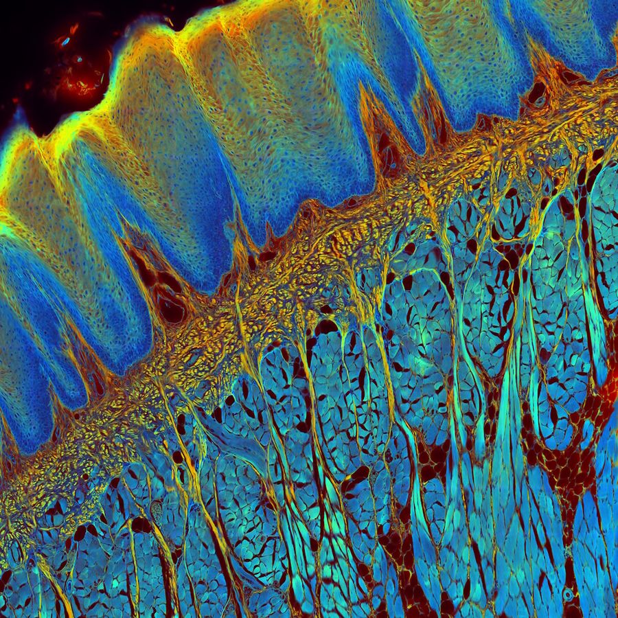 Transverse histological slice of a rabbit tongue (Filiform Papillae). FLIM gives an additional contrast that allows the differentiation of different structures with histological staining.