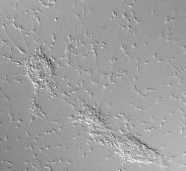 Differential interference contrast (DIC) Differential interference contrast (DIC)