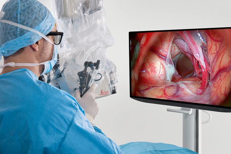 Switch from optical to digital visualizations whenever required.