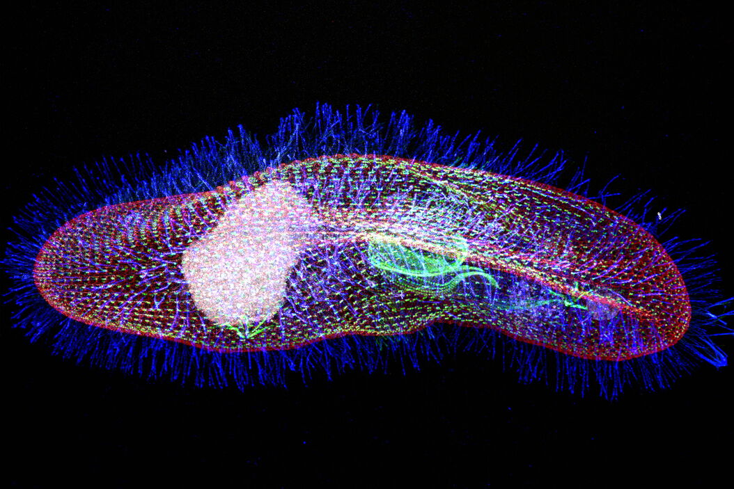 Protist Paramecium (Paramecium tetraurelia) stained to show the nucleus Protist_Paramecium__Paramecium_tetraurelia__stained_to_show_the_nucleus.jpg