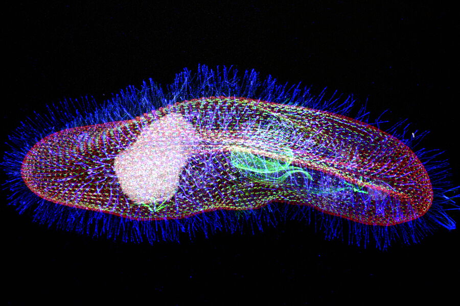 Protist Paramecium (Paramecium tetraurelia) stained to show the nucleus, basal body, a protein ring, the epiplasm, a thin dense layer at the base of a cilia where basal bodies are inserted and the cilia.