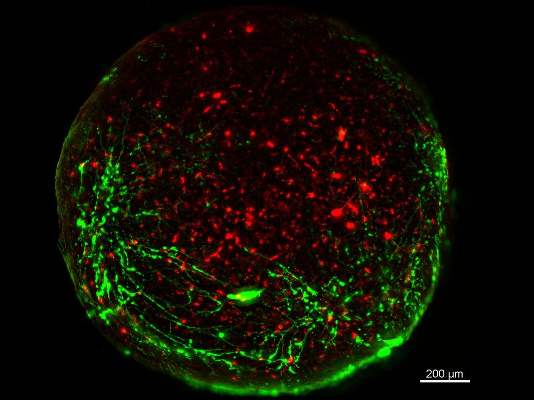 Virally labeled neurons (red) and astrocytes (green) in a cortical spheroid derived from human induced pluripotent stem cells. THUNDER Model Organism Imager with a 2x, 0.15 NA objective at 3.4x zoom was used to produce this 425 µm Z-stack (26 positions) which is presented here as an Extended Depth of Field (EDoF) projection. Images courtesy of Dr. F. Birey, Dr. S. Pasca laboratory, Palo Alto, CA. Virally_labeled_neurons_and_astrocytes_in_a_cortical_spheroid_.jpg
