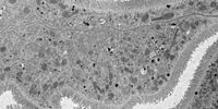 Overview of Drosophila gastric caeca and a mitochondrion with well-defined cristae and well-preserved surrounding membranes. Micrographs courtesy of Dr. Syed (NIH/NIDCR) and Dr. Bleck (NIH/NHLBI) 