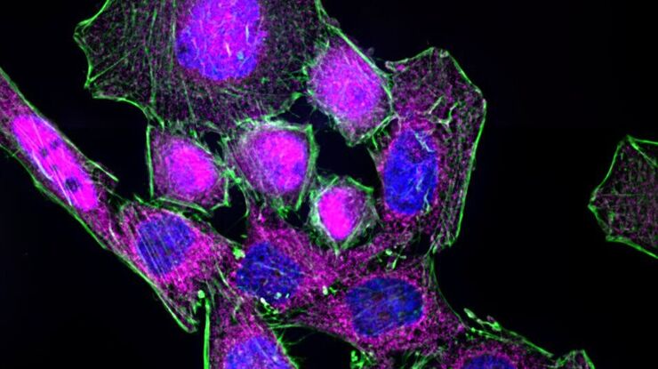 HeLa cells stimulated with LPS. Image has been subjected to deconvolution. HeLa cells stimulated with LPS. Image has been subjected to deconvolution.