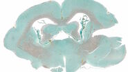 Masson-Goldner staining of a hedgehog brain slice.