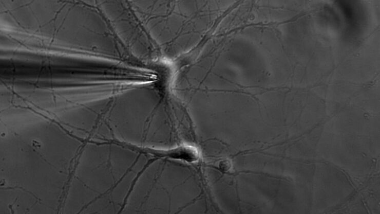 Patch pipette touching a murine hippocampal neuron. Image courtesy of A. Aguado, Ruhr University Bochum, Germany.