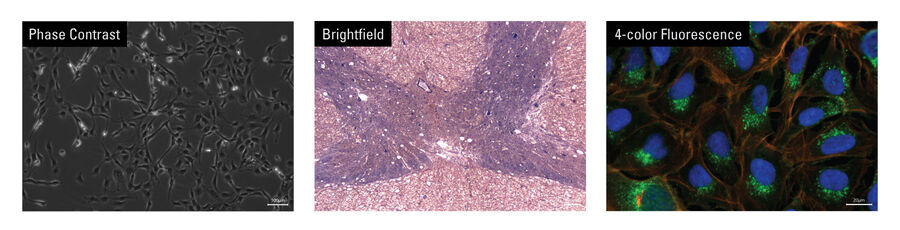 Mateo multi modal imaging