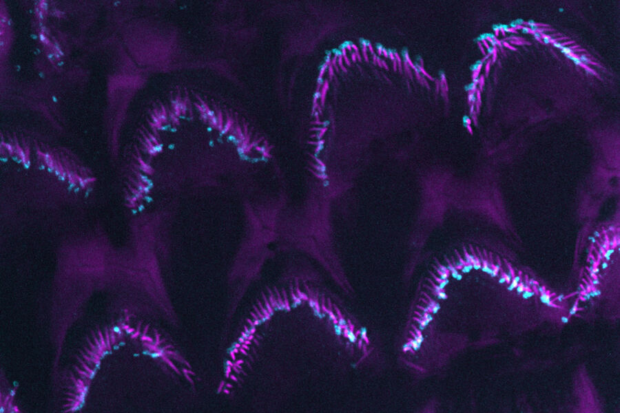 Two-color TauSTED Xtend 589 of the inner ear section of a mouse Two-color TauSTED Xtend 589 of the inner ear section of a mouse