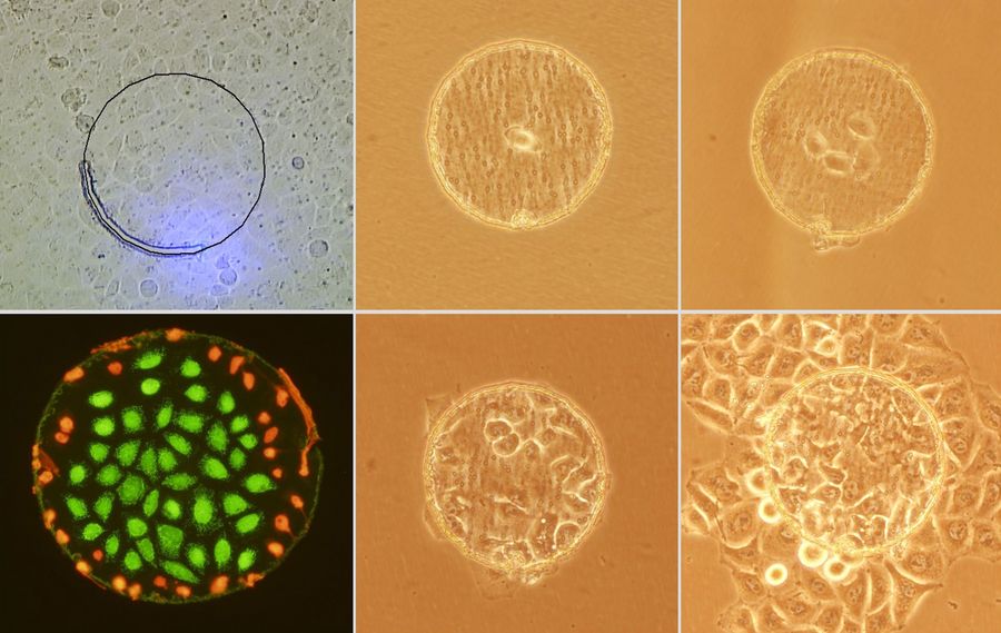 Series of images showing a strategy for efficient isolation of live cells from tissues using laser microdissection (LMD). The LMD-isolated live cells demonstrated colony formation and single cell cloning. Courtesy O. Podgorny, Koltzov Institute of Developmental Biology, Moscow, Russia.