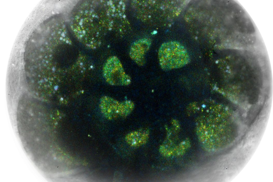 Foraminifera (Ammonia confertitesta) labeled with membrane-permeable calcein, high-pressure frozen in salt water using EM ICE. The sample was cryo-planed and targeted with the M205 on the Cryo-Fluo Enuity, then transferred under cryo conditions to the Cryo-Stellaris for widefield and confocal imaging, revealing details of the staining pattern. Image courtesy: David Evans, University of Southampton. Foraminifera_high-pressure_frozen_using_EM_ICE_teaser.jpg