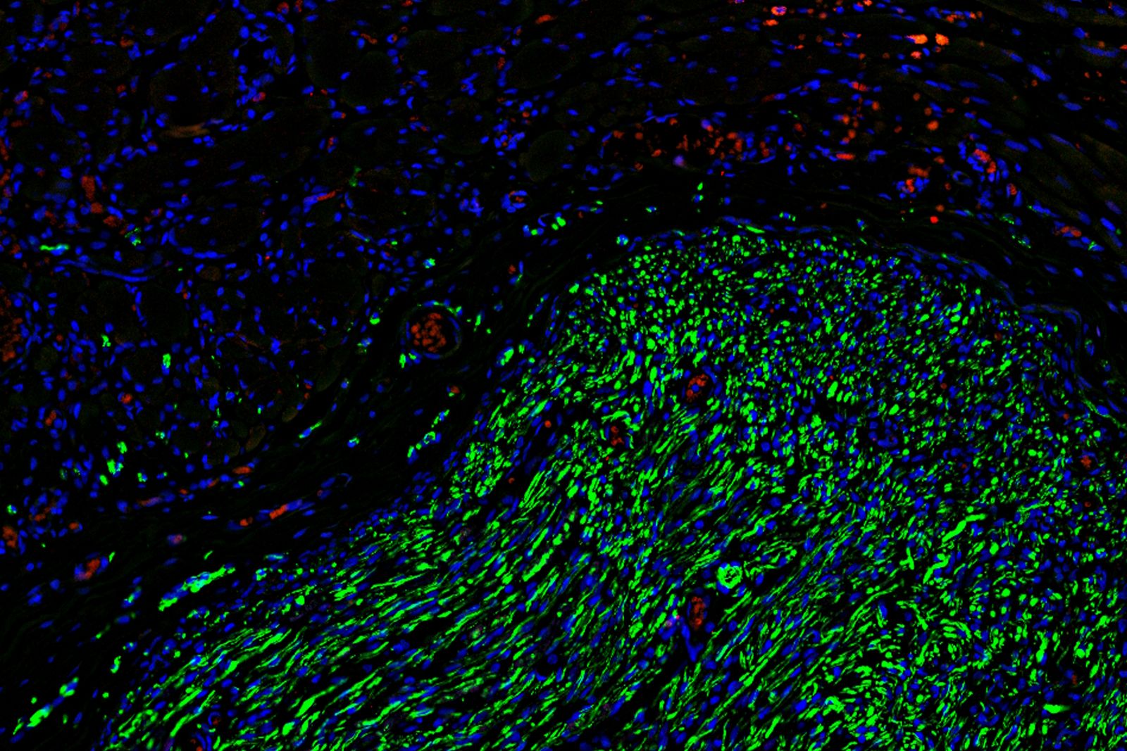 How to Image Axon Regeneration in Deep Muscle Tissue | Learn & Share ...