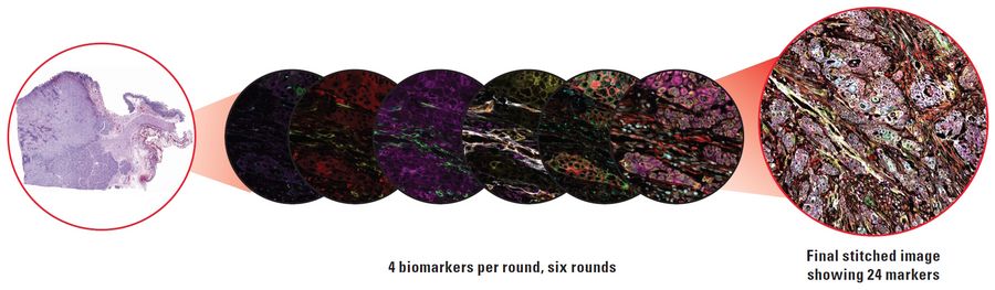 Pancreatic adenocarcinoma imaged with Cell DIVE, an iterative staining multiplex solution.
