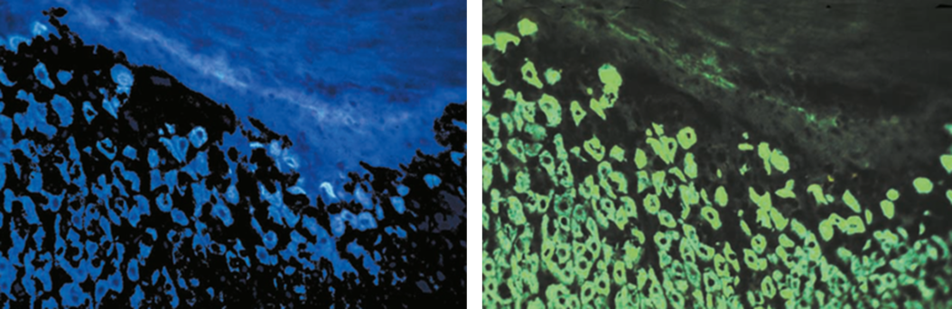 Left: Tissue cells marked with an immunolabel (FITC) illuminated with wide-band UV excitation. Note the tissue structure with blue autofluorescence. Right: Same tissue and same immunostaining with FITC label illuminated with epi-illumination using narrow-band blue (490 nm) light. Note the increased image contrast (Ploem, 1967) Ploem_Figure_5_Autofluorescence_a_b.png