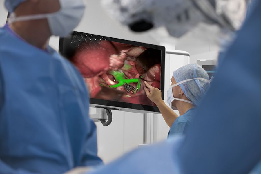 GLOW800 visualization supports each step of vascular neurosurgery.