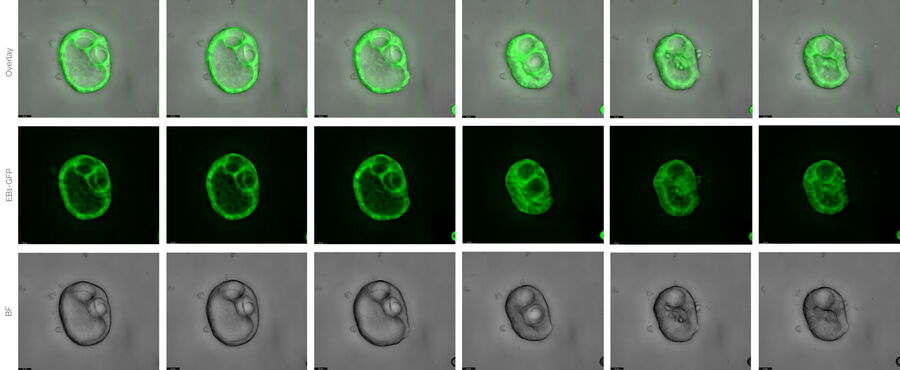 MDCK cysts. Extract of a 3-week live-cell experiment. 