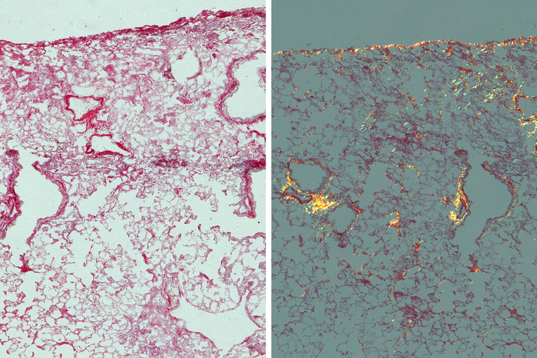 Mouse lung sections Studying_Pulmonary_Fibrosis_Teaser.jpg