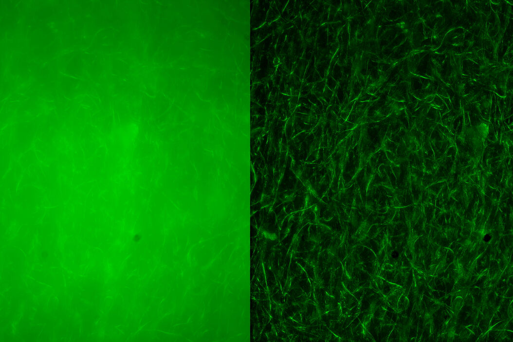 Images of the scaffold composed of fluorescent fibers: Left: raw widefield image. Right: THUNDER image with LVVC. Both images are maximal projections of a z stack of 55 images (total height of 130 µm). Images courtesy of Mollie Smoak, Department of Bioengineering, Rice University, Houston, TX, USA Finding_new_Scaffolds_for_Tissue_Engineering_teaser.jpg