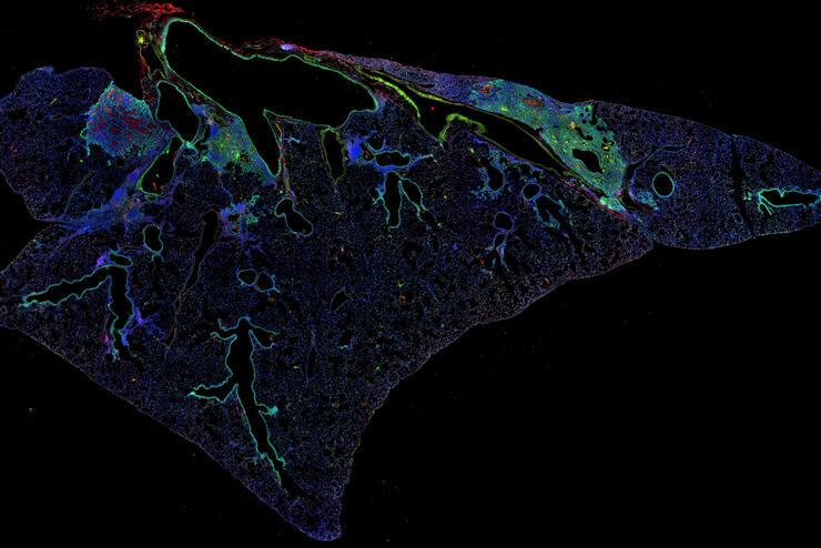 THUNDER image of a section of mouse lung where the mouse was inoculated with the Puerto Rico 8 strain of influenza virus. The lung tissue was immunofluorescently stained with Keratin-5 (green) and PDL-1 (red). Image courtesy of Andrew Beppu, Stripp Lab, Cedars Sinai Medical Center, Los Angeles, USA.