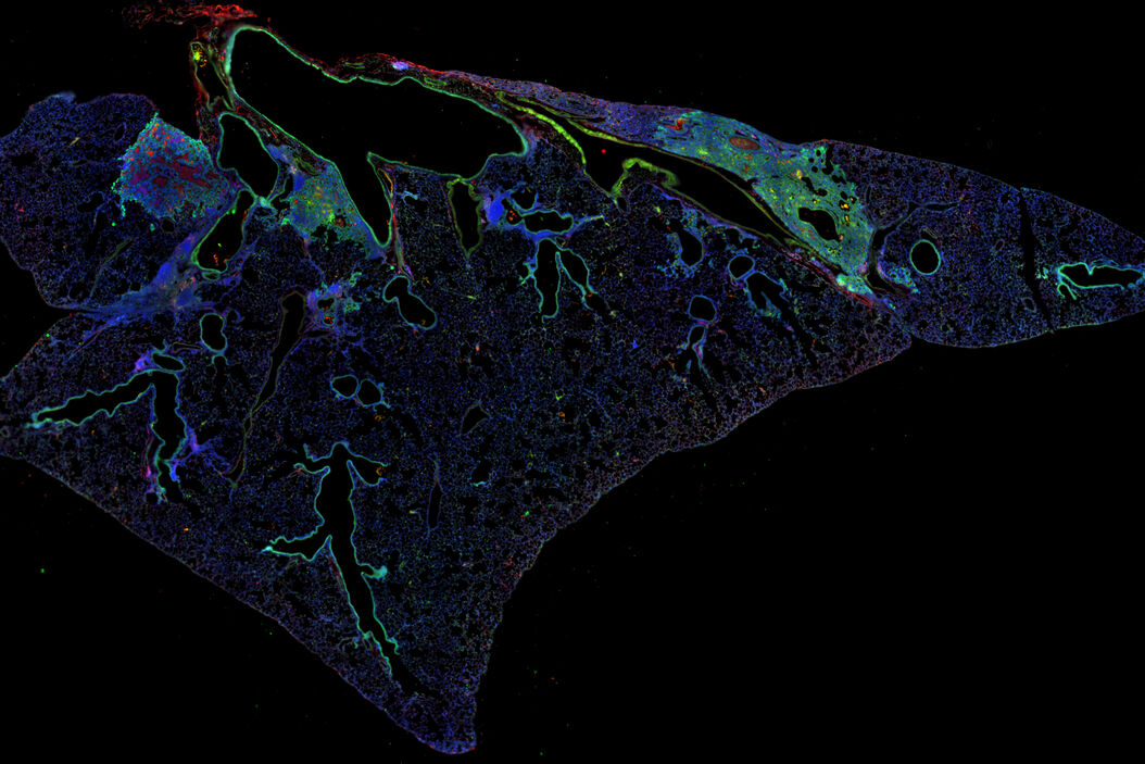 THUNDER image of a section of mouse lung where the mouse was inoculated with the Puerto Rico 8 strain of influenza virus. The lung tissue was immunofluorescently stained with Keratin-5 (green) and PDL-1 (red). Image courtesy of Andrew Beppu, Stripp Lab, Cedars Sinai Medical Center, Los Angeles, USA. Monitoring_immunosuppressive_mechanisms_from_infection_teaser.jpg