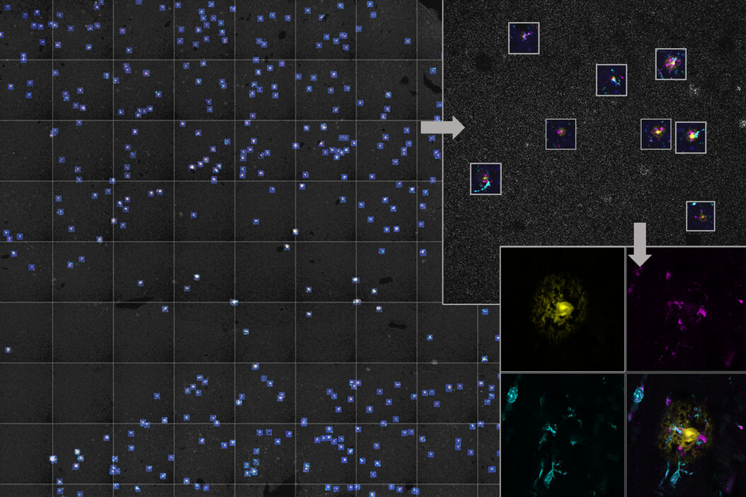 [Translate to chinese:] AI-based workflow for fast rare event detection in living biological samples using Autonomous Microscopy powered by Aivia AI-Workfow_rare-event-detection.jpg