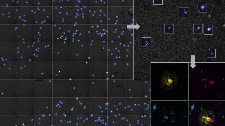 AI-based workflow for fast rare event detection in living biological samples using Autonomous Microscopy powered by Aivia AI-based workflow for fast rare event detection in living biological samples using Autonomous Microscopy powered by Aivia