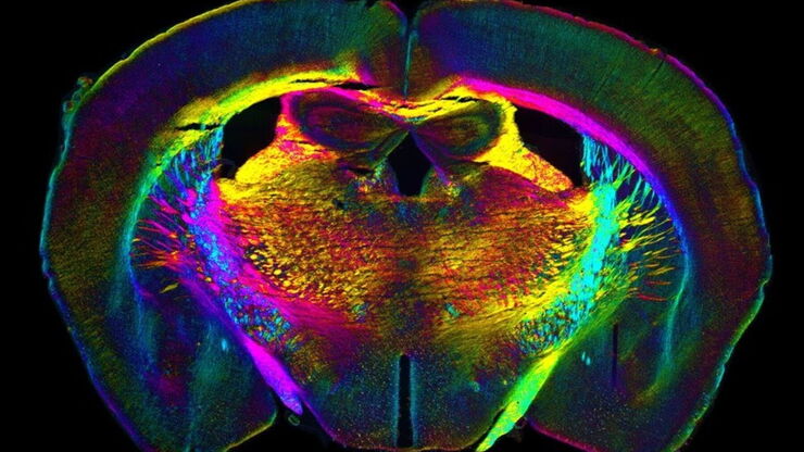 Analysis of anatomy and axon orientation of an adult mouse brain tissue with QLIPP.