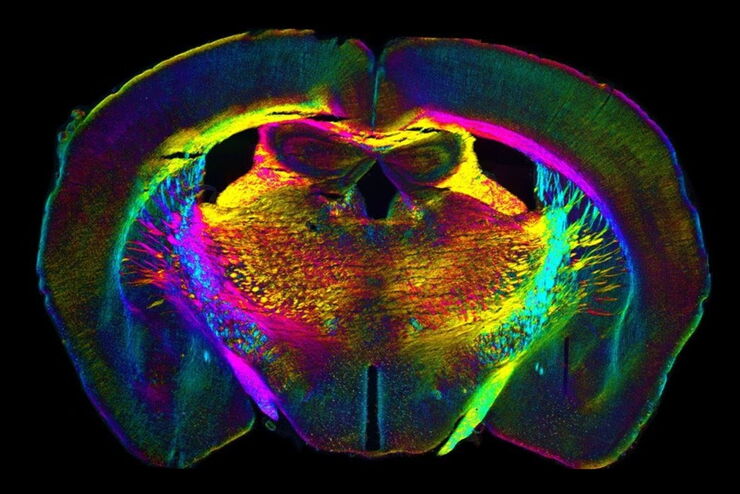 Analysis of anatomy and axon orientation of an adult mouse brain tissue with QLIPP