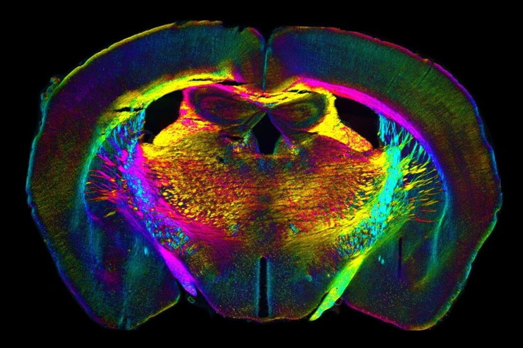 Analysis of anatomy and axon orientation of an adult mouse brain tissue with QLIPP. Learning_the_Cellular_Architecture_from_its_Optical_Properties_teaser.jpg
