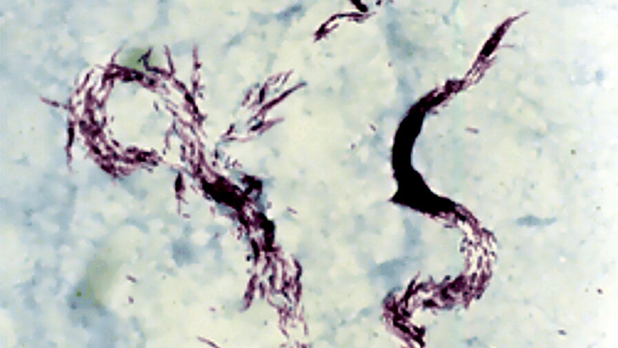Mycobacterium causing tuberculosis Mycobacterium causing tuberculosis