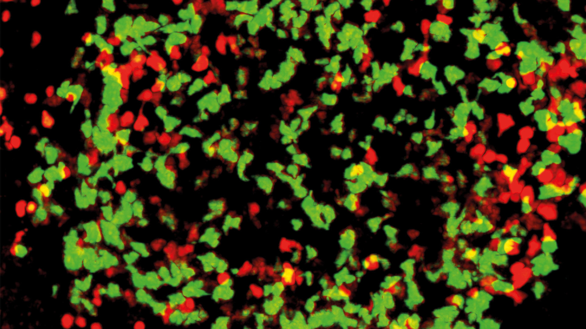 Compound Light Microscopes | Products | Leica Microsystems