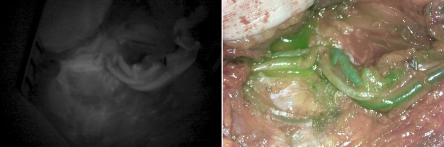 FL800 near infrared fluorescence imaging (left) and GLOW800 Augmented Reality fluorescence imaging (right).