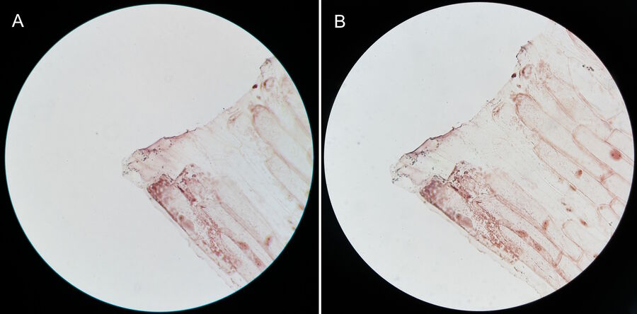 a) Image of an onion flake acquired with a basic Leica compound microscope using a 40x achromatic objective and 10x eyepiece before the ISO 9022-11 test. b) Another image of the onion flake seen in 2a acquired with the same Leica compound microscope, objective, and eyepiece after the ISO 9022-11 test.