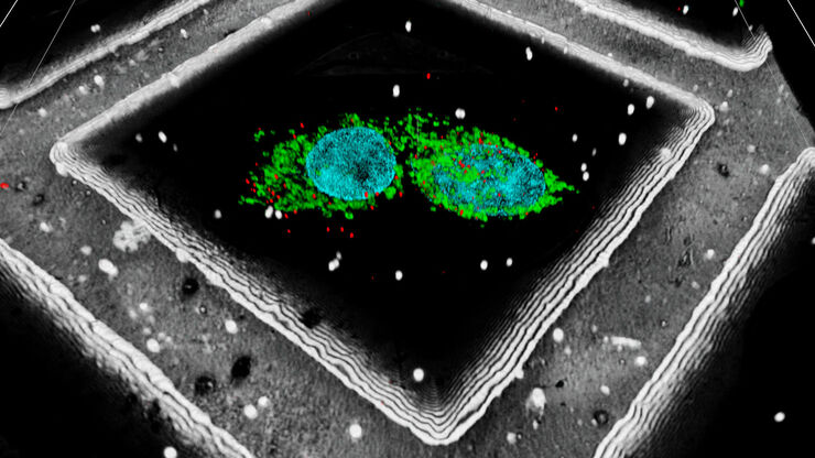 HeLa cells. Cells kindly provided by I. Zagoriy, Mahamid Group, EMBL Heidelberg HeLa cells labeled with dark blue – Hoechst, Nuclei; magenta – MitoTracker Green, Mitochondria; turquoise - Bodipy, lipid droplets. Cells kindly provided by Ievgeniia Zagoriy, Mahamid Group, EMBL Heidelberg, Germany.