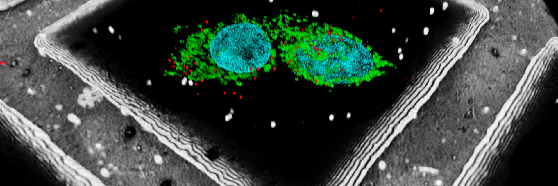 LNG-non-LNGHeLa cells labeled with light blue – Hoechst