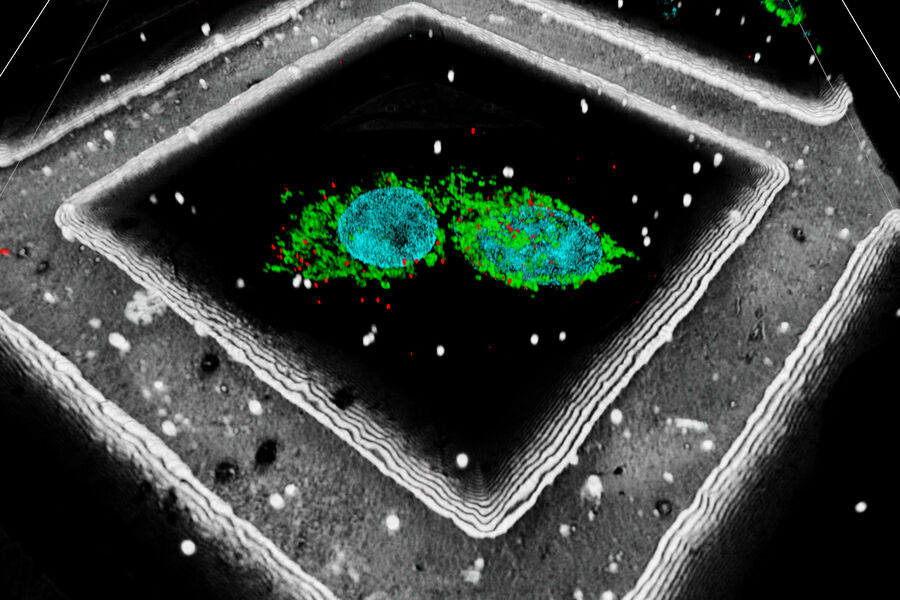 LNG-non-LNGHeLa cells labeled with light blue –Hoechst, Nuclei; green –MitoTracker Green, Mitochondria; red -Bodipy, lipid droplets. White – beads, Reflection mode – grid bars. Cells kindly provided by Ievgeniia Zagoriy, Mahamid Group, EMBL Heidelberg, Germany.