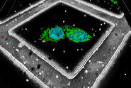 LNG-non-LNGHeLa cells labeled with light blue –Hoechst, Nuclei