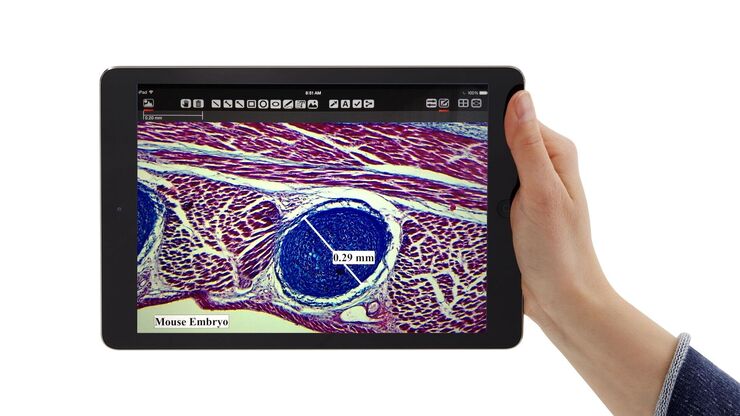 Image on tablet with annotations
