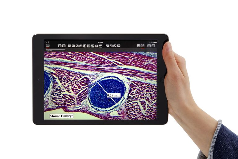 Tablet showing AirLab App with Annotation & Measuring Function (Compound Image: Mouse Embryo)