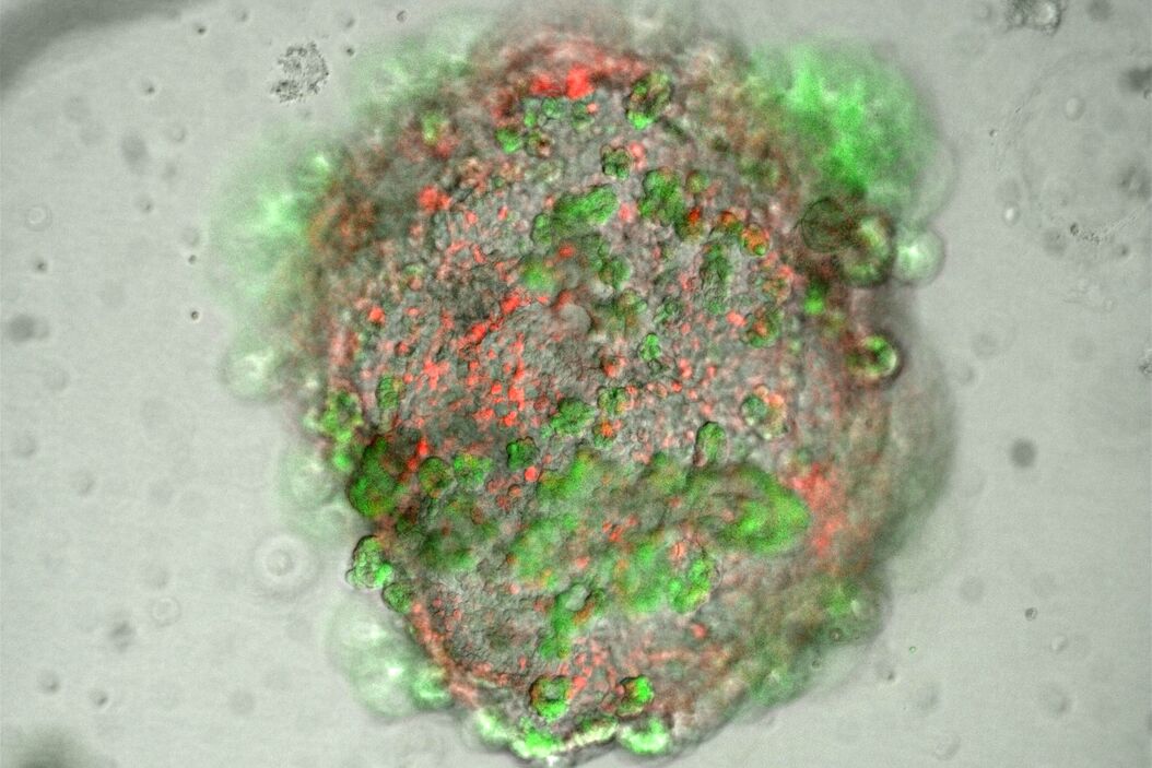 Lung organoid taken at the "liquid-air interface" with a THUNDER Imager 3D Cell Culture. The cells originate from transgenic mice, so that the different fluorescence represents the degree of differentiation of the respective cell (superposition). The image acquisition was performed on day 21 after the start of the culture. Reference: P. Kanrai, MPI-HLR Bad Nauheim. Lung-Organoid_Transgenic-mice.jpg