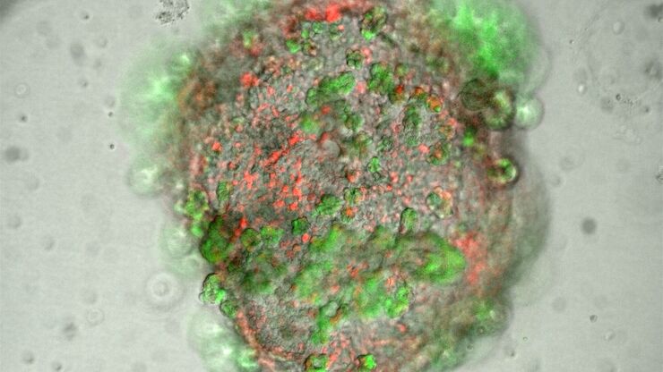 Lung organoid taken at the "liquid-air interface" with a THUNDER Imager 3D Cell Culture Lung organoid taken at the "liquid-air interface" with a THUNDER Imager 3D Cell Culture. The cells originate from transgenic mice, so that the different fluorescence represents the degree of differentiation of the respective cell (superposition). The image acquisition was performed on day 21 after the start of the culture. Reference: P. Kanrai, MPI-HLR Bad Nauheim.
