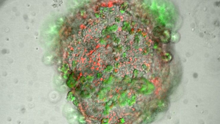 Lung organoid taken at the "liquid-air interface" with a THUNDER Imager 3D Cell Culture. The cells originate from transgenic mice, so that the different fluorescence represents the degree of differentiation of the respective cell (superposition). The image acquisition was performed on day 21 after the start of the culture. Reference: P. Kanrai, MPI-HLR Bad Nauheim.