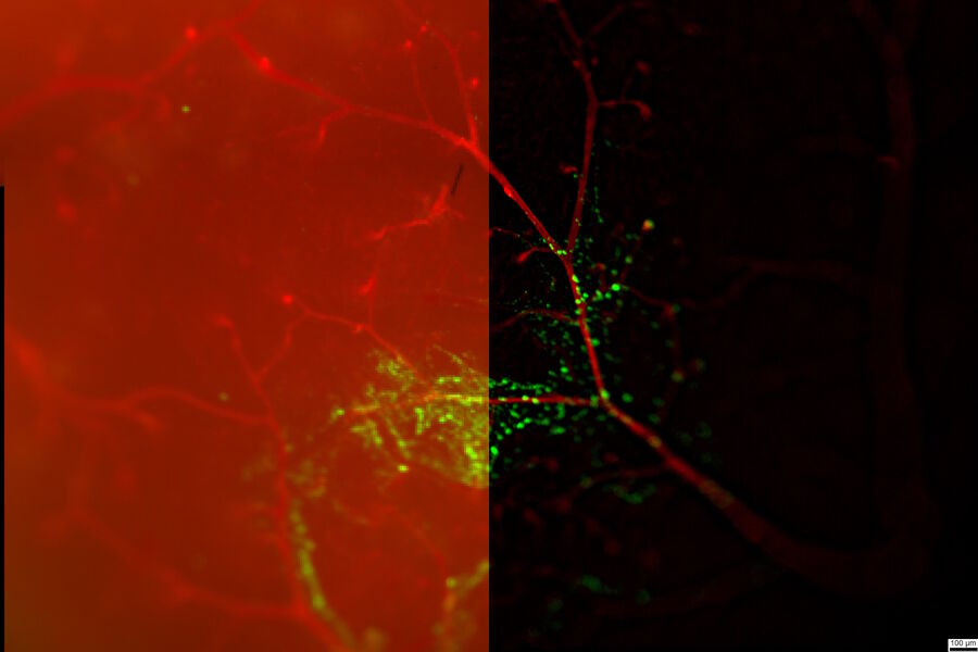 Mouse brain cortex - THUNDER Imager