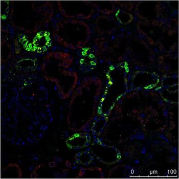 [Translate to German:] The Immunhistochemistry (IHC) staining of a human kidney displays different cell types in different structures