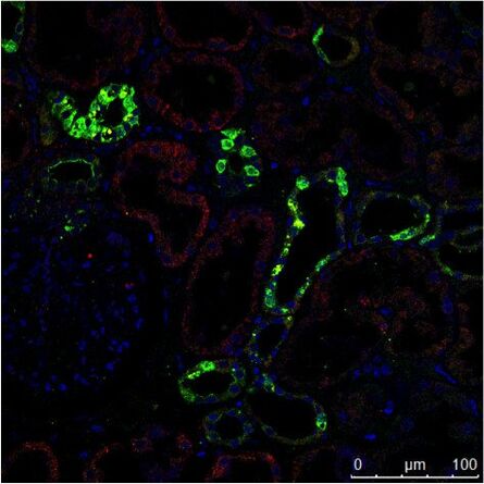 The Immunhistochemistry (IHC) staining of a human kidney displays different cell types in different structures