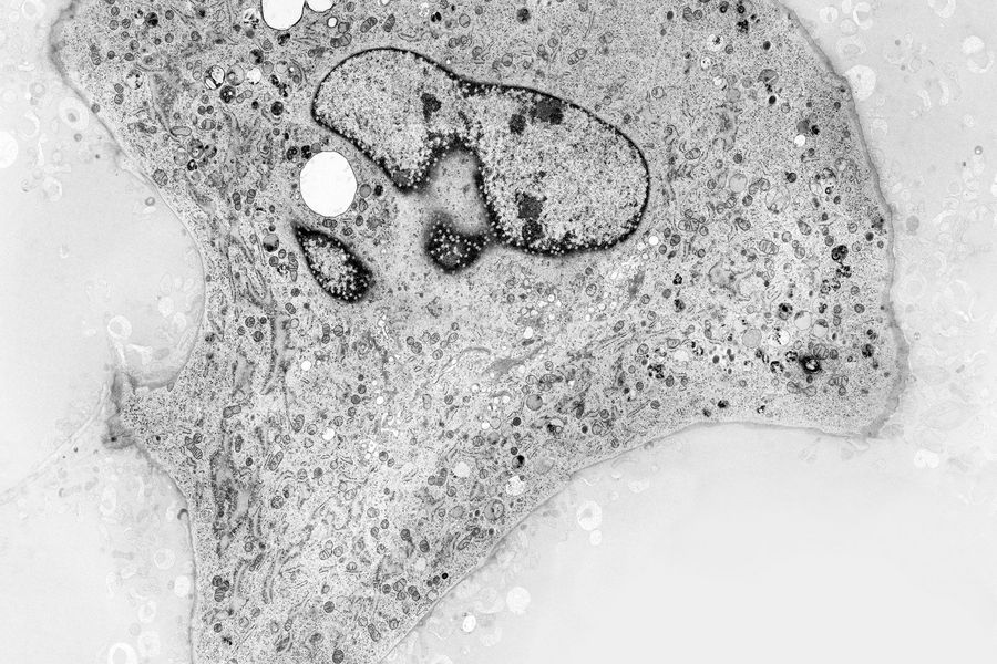 Mouse embryonic fibroblast grown on a sapphire disc imaged with EM. Courtesy of P. Verkade, University of Bristol, UK.