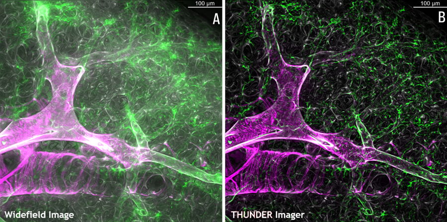 Mouse lung raw widefield vs Instant Computational Clearing (ICC)