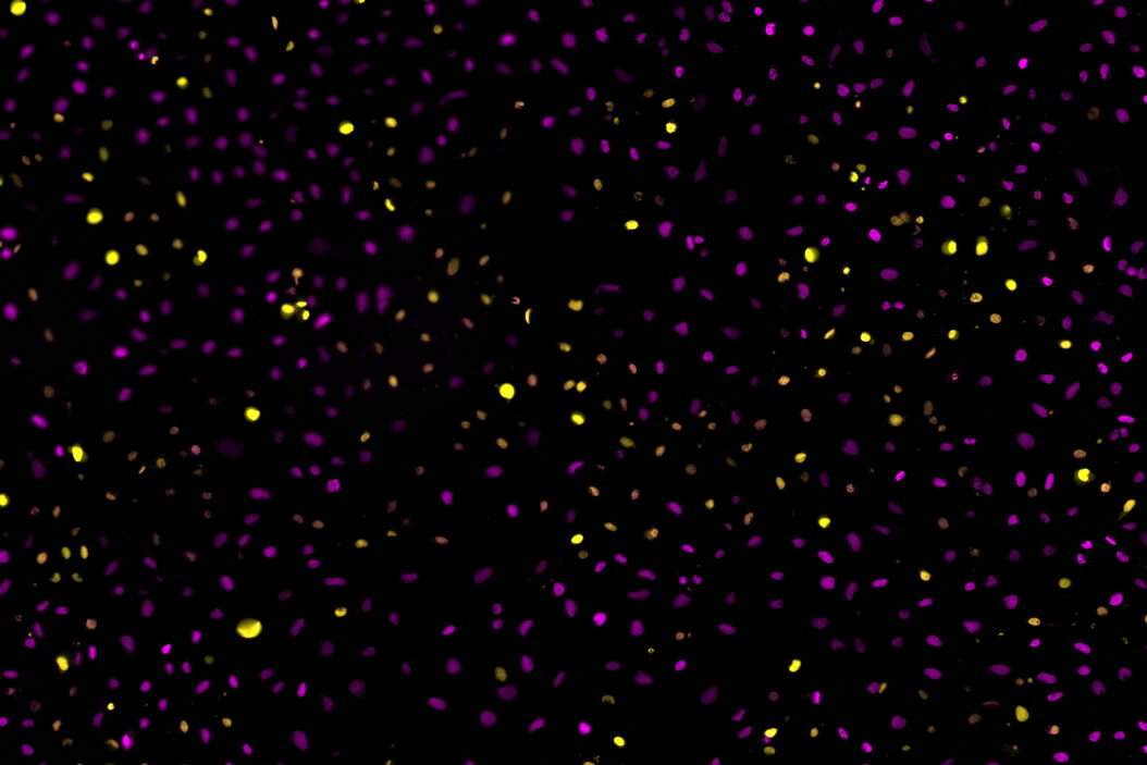 Two-color caspase assay with tile scan Two-color_caspase_assay_with_tile_scan.jpg