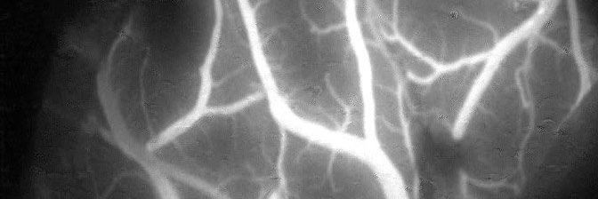 FL800 fluorescence